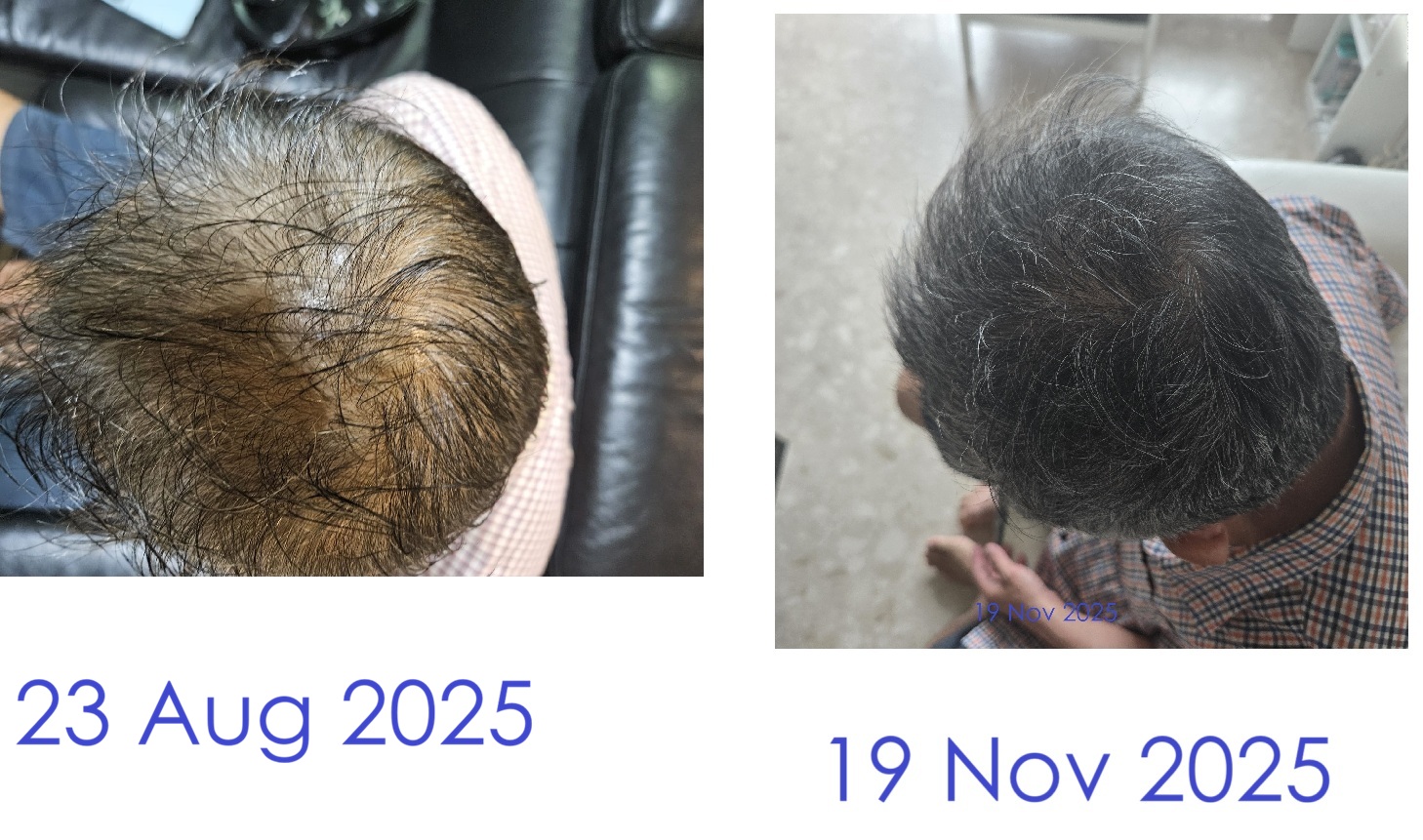 Thank God for Hair Regrowth